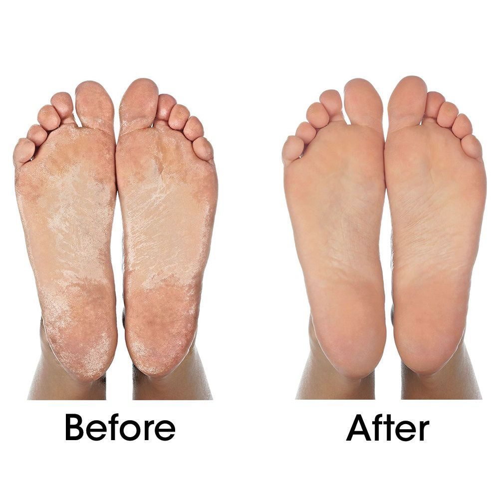 Step Confidently into Smooth, Beautiful Feet!