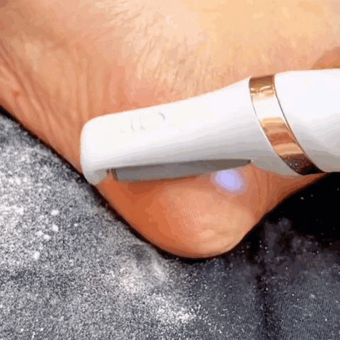 Silky Feet Callus Remover™