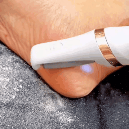 Silky Feet Callus Remover™