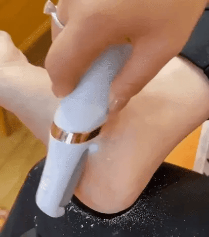 Silky Feet Callus Remover™